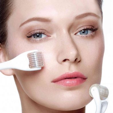 microneedling